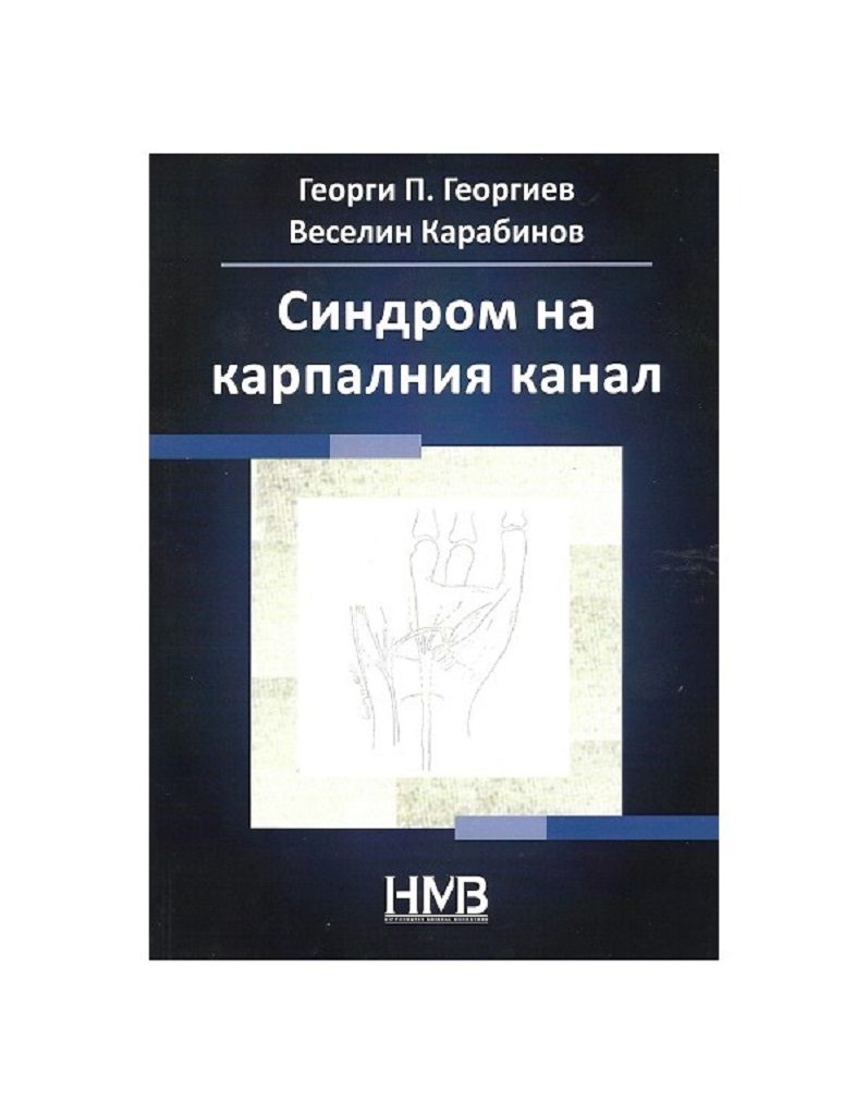 Cиндром на Карпалния Канал